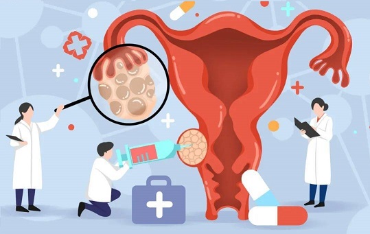 李女士的故事：跨越排卵障碍，迎接宝宝诞生